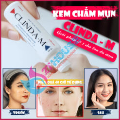 Kem chấm mụn Clinda-M Thái Lan