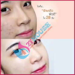 Kem chấm mụn Clinda-M Thái Lan