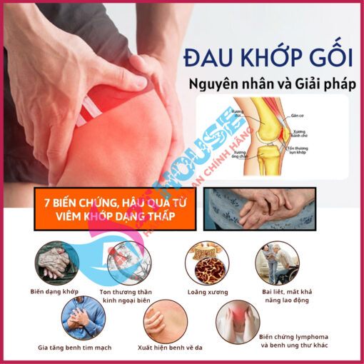 Thuốc trị xương khớp Noxa20 Thái Lan giảm đau gối gout (gút)